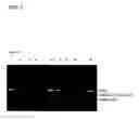 Fig. 06 - RNA extraction method, RNA extraction reagent, and method for analyzing biological materials