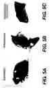 Fig. 05 - Knockout mouse for the tumor suppressor gene ANX7