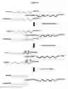 Fig. 02 - Method for depleting specific nucleic acids from a mixture