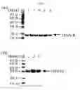 Fig. 06 - Composition for protecting proteins degradation comprising small heat shock proteins (sHSPs) and method of two-dimensional gel electrophoresis using the sHSPs