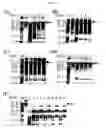 Fig. 07 - Composition for protecting proteins degradation comprising small heat shock proteins (sHSPs) and method of two-dimensional gel electrophoresis using the sHSPs