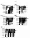 Fig. 08 - Composition for protecting proteins degradation comprising small heat shock proteins (sHSPs) and method of two-dimensional gel electrophoresis using the sHSPs