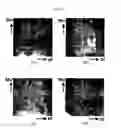 Fig. 09 - Composition for protecting proteins degradation comprising small heat shock proteins (sHSPs) and method of two-dimensional gel electrophoresis using the sHSPs