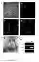 Fig. 07 - Methods of isolation, expansion and differentiation of fetal stem cells from chorionic villus, amniotic fluid, and placenta and therapeutic uses thereof