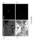 Fig. 03 - Human mesencephalon cell lines and methods of use therefor