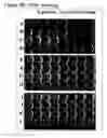Fig. 08 - Attached cell lines