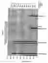 Fig. 02 - Transfection reagents
