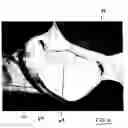 Fig. 06 - Cushioned underwire