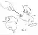 Fig. 09 - Method of preparing a bird for grilling and resulting bird product