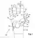 Fig. 02 - Dynamic gauntlet