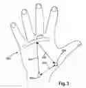 Fig. 04 - Dynamic gauntlet