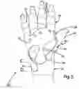 Fig. 06 - Dynamic gauntlet