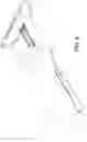 Fig. 07 - Muscle stretching device and method for using the same