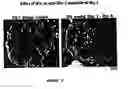 Fig. 09 - Methods for treating conditions associated with the accumulation of excess extracellular matrix