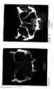 Fig. 02 - Methods and materials for treating and preventing inflammation of mucosal tissue
