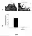 Fig. 06 - Methods of modulating angiogenesis and cancer cell proliferation