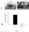 Fig. 08 - Methods of modulating angiogenesis and cancer cell proliferation