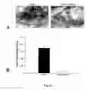 Fig. 09 - Methods of modulating angiogenesis and cancer cell proliferation