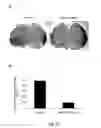 Fig. 22 - Methods of modulating angiogenesis and cancer cell proliferation