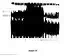 Fig. 23 - Methods and compositions for increasing CD4lymphocyte immune responsiveness