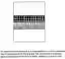 Fig. 01 - Absorbent polymeric material