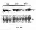 Fig. 22 - Mammalian migration inducting gene and methods for detection and inhibition of migrating tumor cells