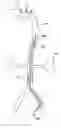 Fig. 01 - Partial aortic occlusion devices and methods for cerebral perfusion augmentation