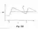 Fig. 07 - Partial aortic occlusion devices and methods for cerebral perfusion augmentation