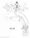 Fig. 33 - Partial aortic occlusion devices and methods for cerebral perfusion augmentation