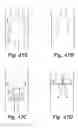 Fig. 46 - Partial aortic occlusion devices and methods for cerebral perfusion augmentation