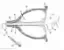 Fig. 01 - Method and device for the treatment of incontinence