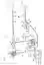 Fig. 02 - Insertion assisting tool for endoscope