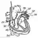 Fig. 01 - Apparatus and method for measuring myocardial oxygen consumption