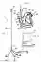 Fig. 02 - Apparatus and method for measuring myocardial oxygen consumption