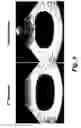 Fig. 08 - Tissue imaging at superharmonic frequencies