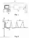 Fig. 02 - Apparatus, system and method for evaluation of esophageal function