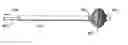 Fig. 01 - Particle-removing medical device and method