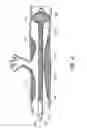 Fig. 07 - Particle-removing medical device and method