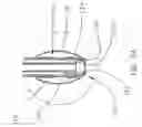 Fig. 04 - Venting catheter