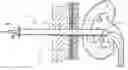 Fig. 01 - Expandable percutaneous sheath