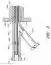 Fig. 06 - Expandable percutaneous sheath