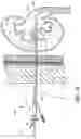 Fig. 08 - Expandable percutaneous sheath