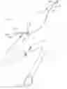 Fig. 01 - Facilitated balloon catheter exchange