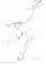 Fig. 02 - Facilitated balloon catheter exchange