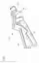 Fig. 02 - Needle shield assembly having hinged needle shield and flexible cannula lock