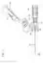 Fig. 06 - Needle shield assembly having hinged needle shield and flexible cannula lock