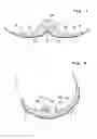 Fig. 07 - Elongated absorbent article