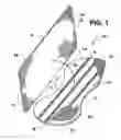 Fig. 02 - Combination pouch/backing sheet for personal care absorbent articles with mechanical attachment system