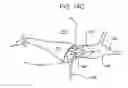 Fig. 16 - Methods and devices for retrieval of a medical agent from a physiological efferent fluid collection site