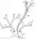 Fig. 01 - Apparatus and methods for treating stroke and controlling cerebral flow characteristics
